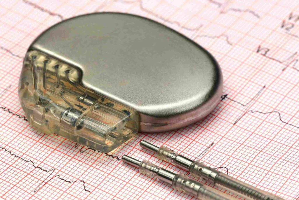 Stimulateurs cardiaques (pacemaker) – rythmologie-pitie