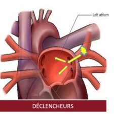 shema declencheurs